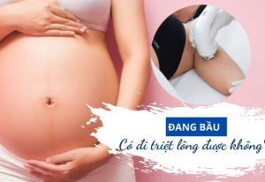 bà bầu có triệt lông được không