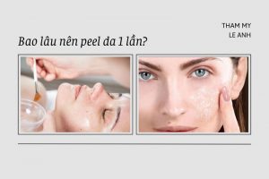 Bao lâu nên peel da 1 lần