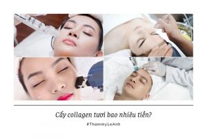 Cấy collagen tươi bao nhiêu tiền