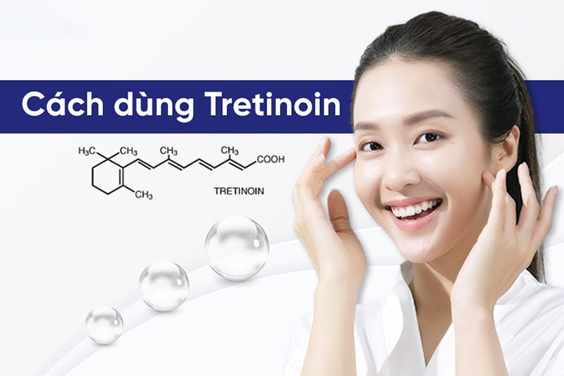 Công dụng Tretinoin trị mụn hiệu quả với cách dùng đơn giản