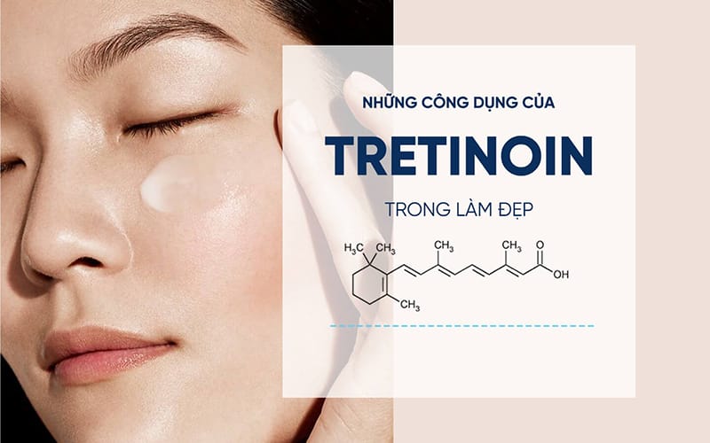 Công dụng Tretinoin giúp điều chỉnh quá trình sản xuất bã nhờn của da, từ đó ngăn ngừa mụn hình thành trong tương lai.