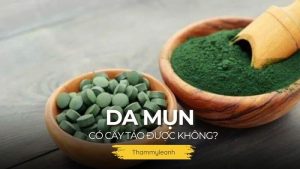 da mụn có cấy tảo được không